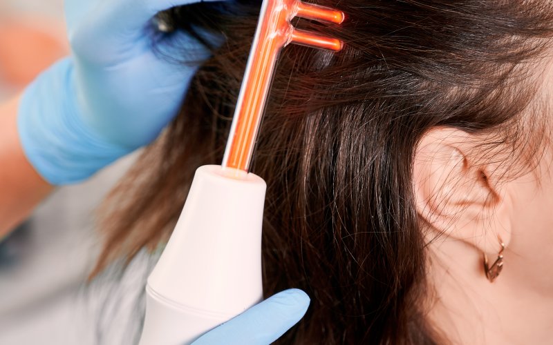 Kayseri'de Saç Dökülmesine Son: Enza ile Dermapen ve Mezoterapi Mucizesi